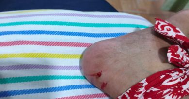 Evakuasi Cepat Damkar Mat, Ular Kobra yang Gigit Warga Banyuwangi Saat Hendak ke Musholla Berhasil Diamankan. Evakuasi Cepat Damkar Mat, Ular Kobra yang Gigit Warga Banyuwangi Saat Hendak ke Musholla Berhasil Diamankan.